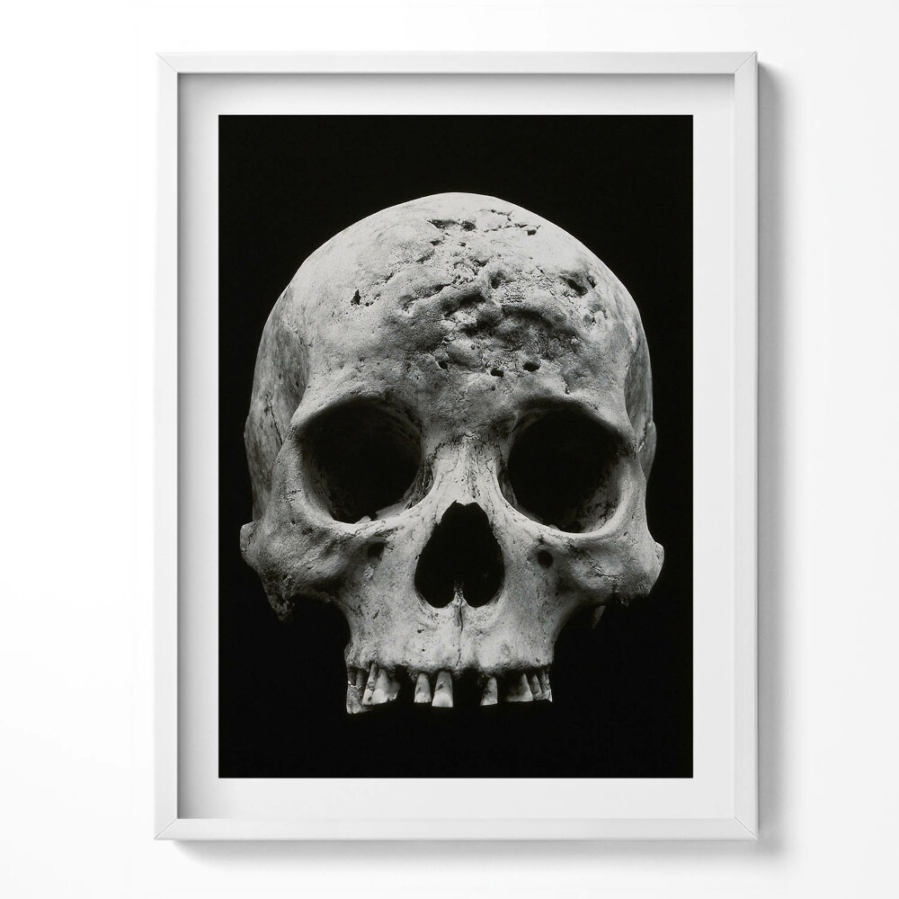 Tablou living cu rama Schelet de craniu uman