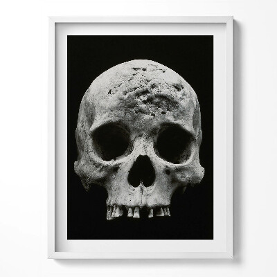 Tablou living cu rama Schelet de craniu uman
